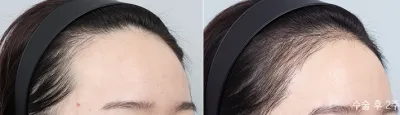 Before & After