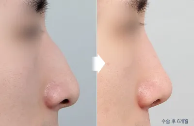 Before & After