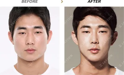 Before & After
