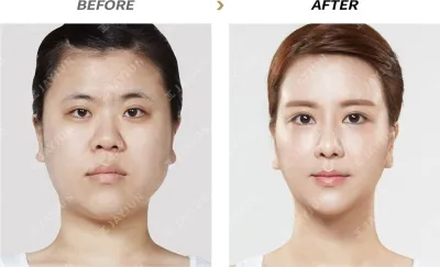 Before & After