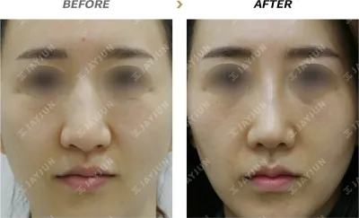 Before & After