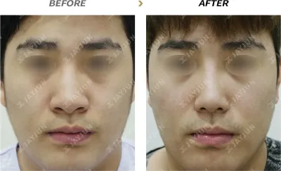 Before & After