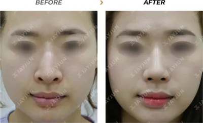 Before & After