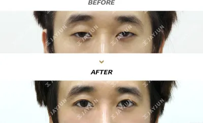 Before & After