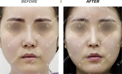 Before & After