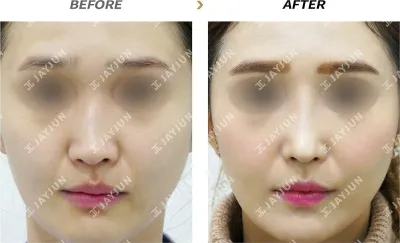 Before & After