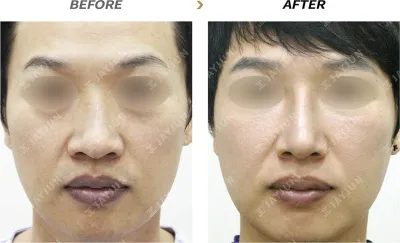 Before & After