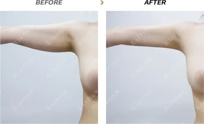 Before & After