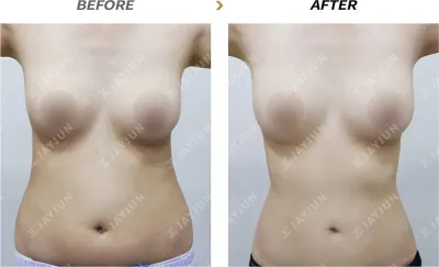 Before & After