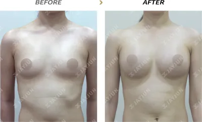 Before & After