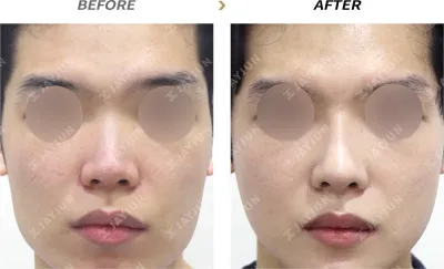 Before & After