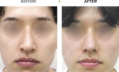Before & After
