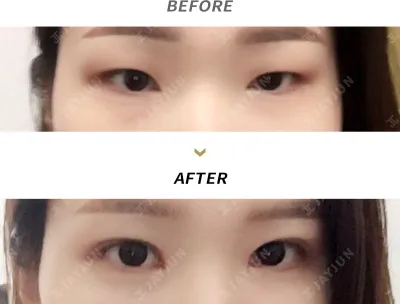 Before & After