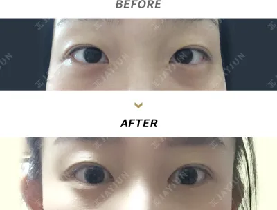Before & After