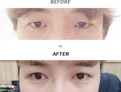 Before & After