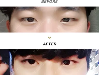Before & After