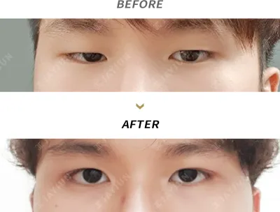 Before & After
