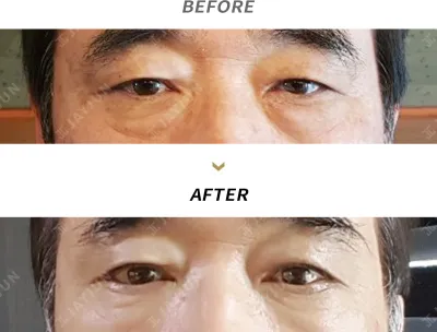 Before & After