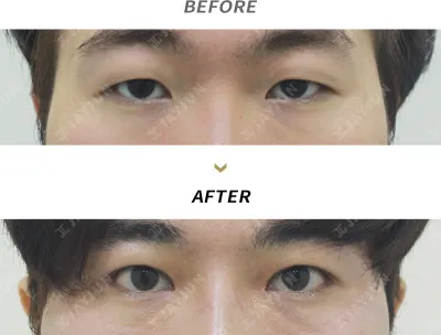 Before & After