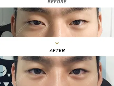 Before & After