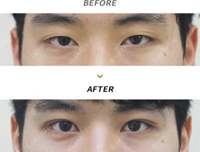 Before & After