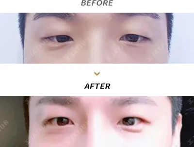 Before & After