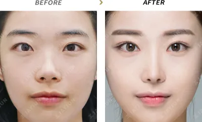 Before & After