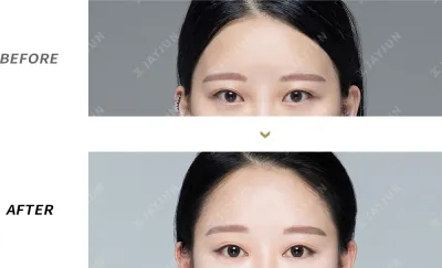 Before & After