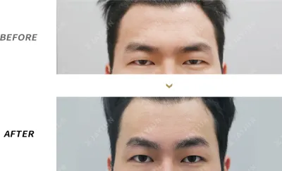 Before & After