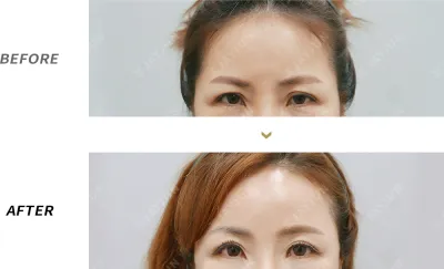 Before & After