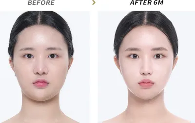 Before & After