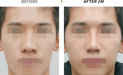 Before & After