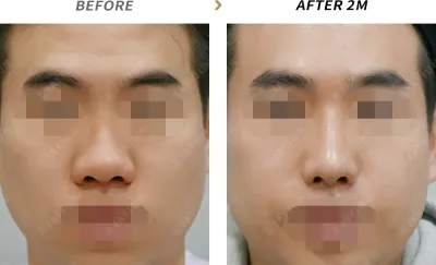 Before & After