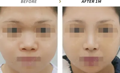 Before & After
