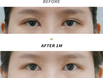 Before & After