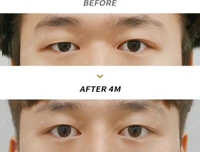 Before & After