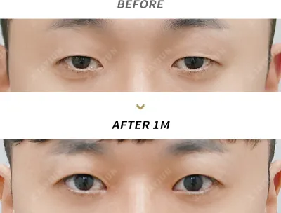 Before & After