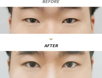 Before & After