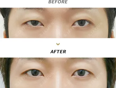 Before & After