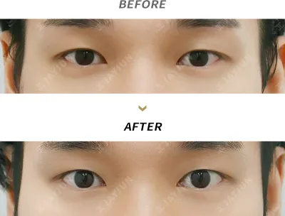 Before & After