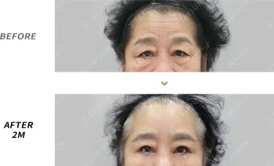 Before & After