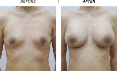 Before & After