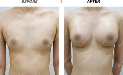 Before & After