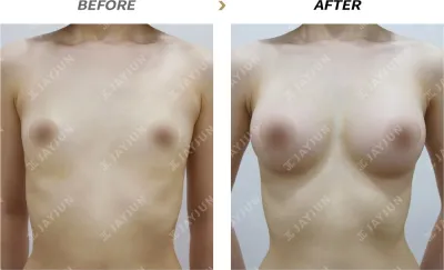 Before & After