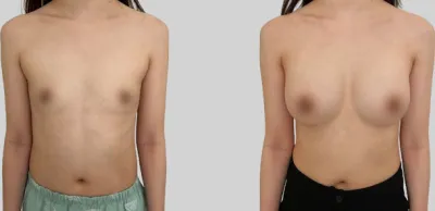 Before & After