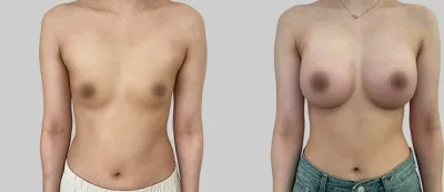 Before & After