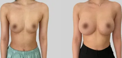 Before & After