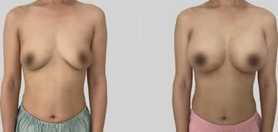 Before & After