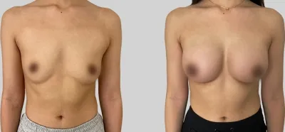 Before & After
