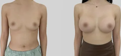 Before & After
